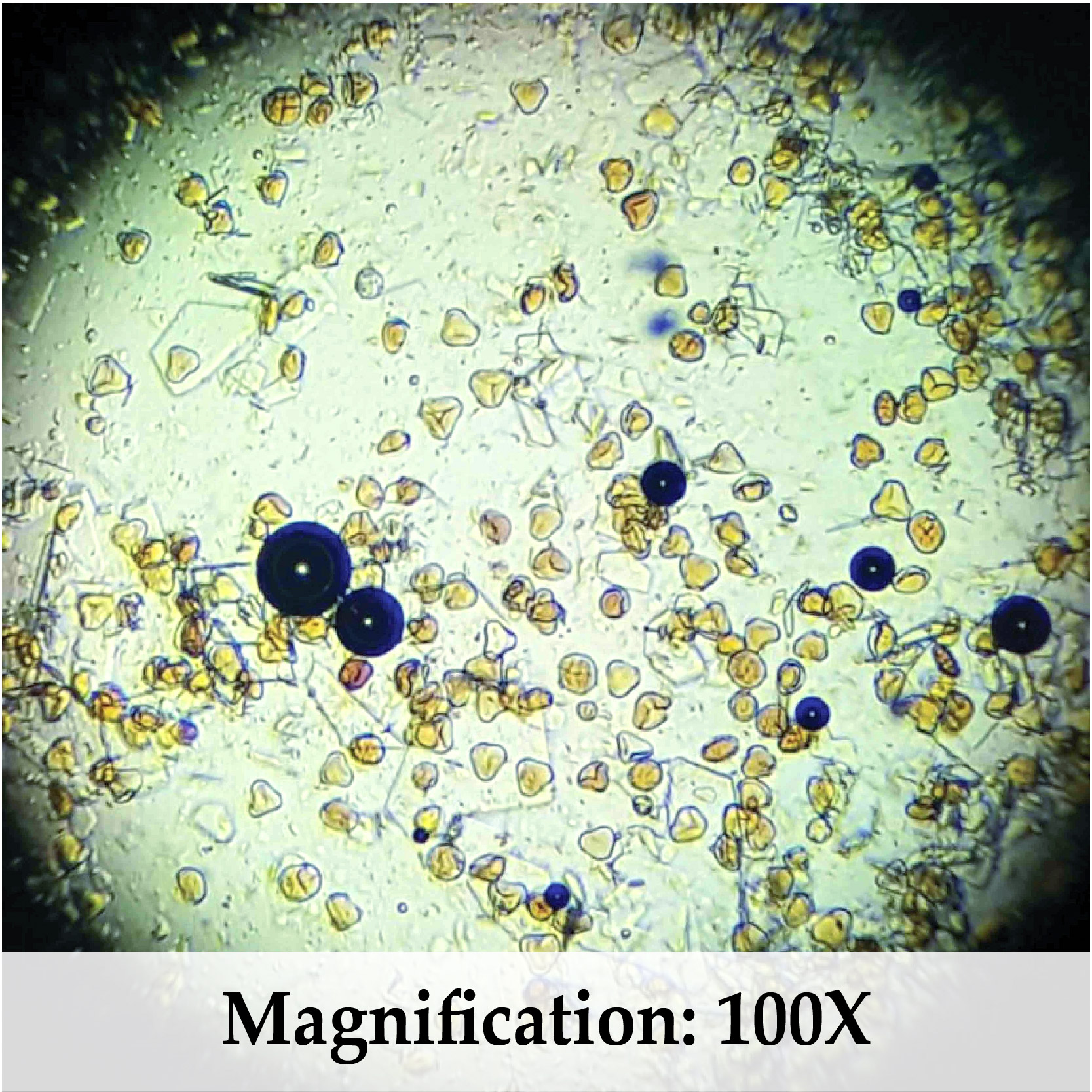 Microscope view at 100X magnification showing pollen grains naturally present in raw Red Tualang Honey from Sumatra.